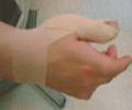 親指の腱鞘炎のテーピング